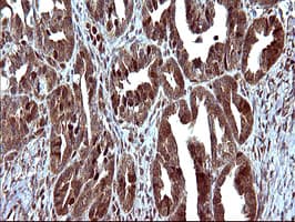 UPRT Antibody (clone OTI2D1)