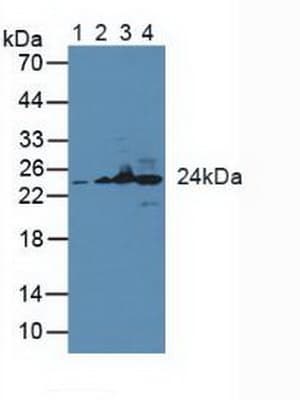 GSTK1 Antibody (aa19-222)