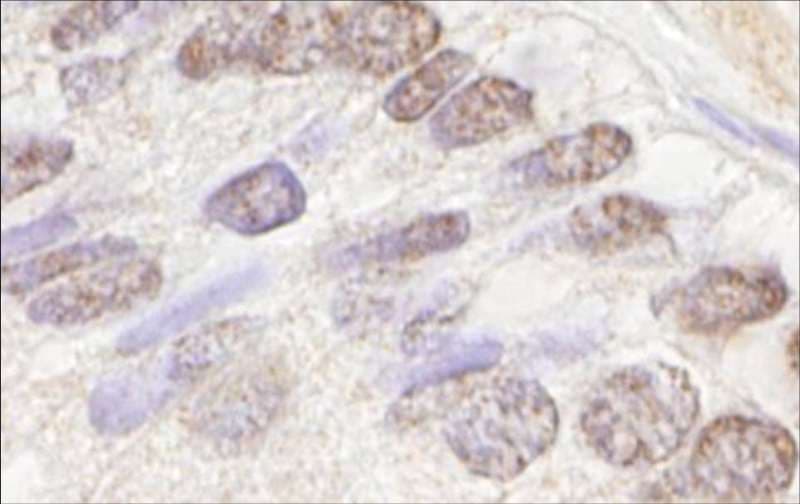 ATM Antibody (aa2550-2600)