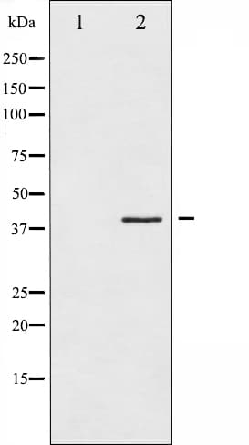 HNRNPC / HNRNP C Antibody (phospho-Ser260)