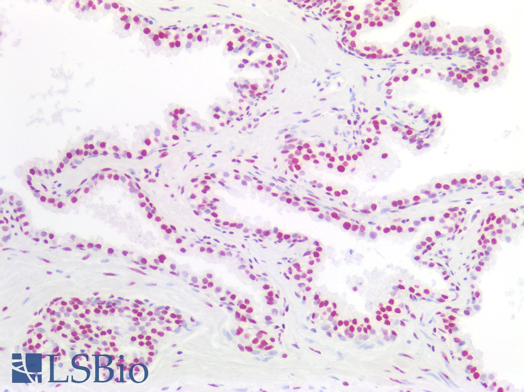 PathPlus™ NPM1 / NPM / Nucleophosmin Antibody (clone AT23F1)