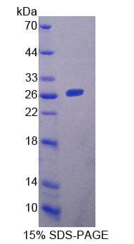 Mouse YAF2 Protein (Recombinant His-T7)