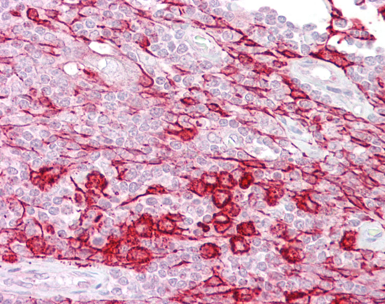 ATF1 Antibody (aa179-228)