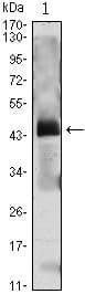 Monoclonal Mouse anti-Human PTH / Parathyroid Hormone Antibody (clone 2C7, Amino Acid: 1-115, WB)