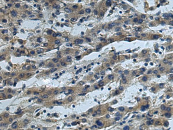Polyclonal Rabbit anti-Human CUL5 / Cullin-5 Antibody (IHC)
