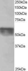 IHC-plus™ Polyclonal Goat anti-Human QIP1 / KPNA4 Antibody (aa509-521, IHC, WB)