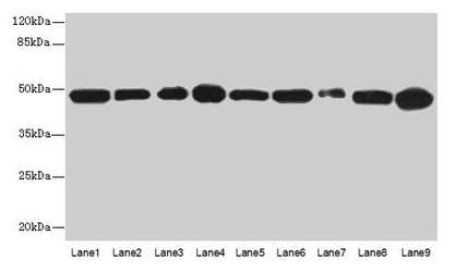 IHC-plus™ Polyclonal Rabbit anti-Human GOT2 Antibody (IHC, WB)