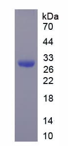 Mouse TRXR1 / TXNRD1 Protein (Recombinant His-T7)
