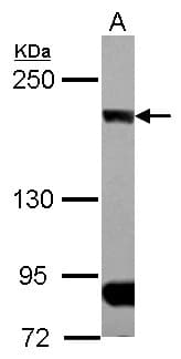 CLIP1 / CLIP-170 Antibody (N-Terminus)