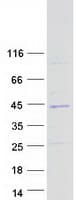 Human SNX20 Protein (Recombinant Myc-DDK (Flag))