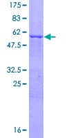 Human LIMS1 / PINCH Protein (Recombinant GST)