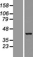 GTPBP10 Protein (Over-Expression Lysate Myc-DDK (Flag))