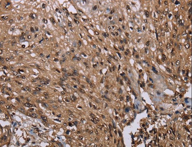 Polyclonal Rabbit anti-Human MEIS1 Antibody (IHC)