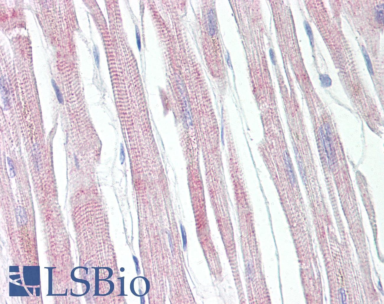 IHC-plus™ APAF1 / APAF-1 Antibody (aa289-338)