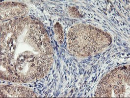 AGPAT5 Antibody (clone OTI2C4)