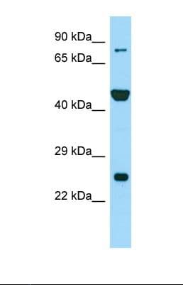 PADI6 Antibody (aa156-205)