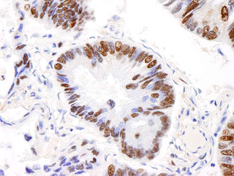 AKAP8L Antibody (aa596-646)