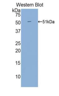 ITGB1 / Integrin Beta 1 / CD29 Antibody (aa467-635, Biotin)