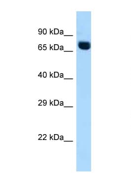 ACSS2 / ACAS2 Antibody (aa645-694)