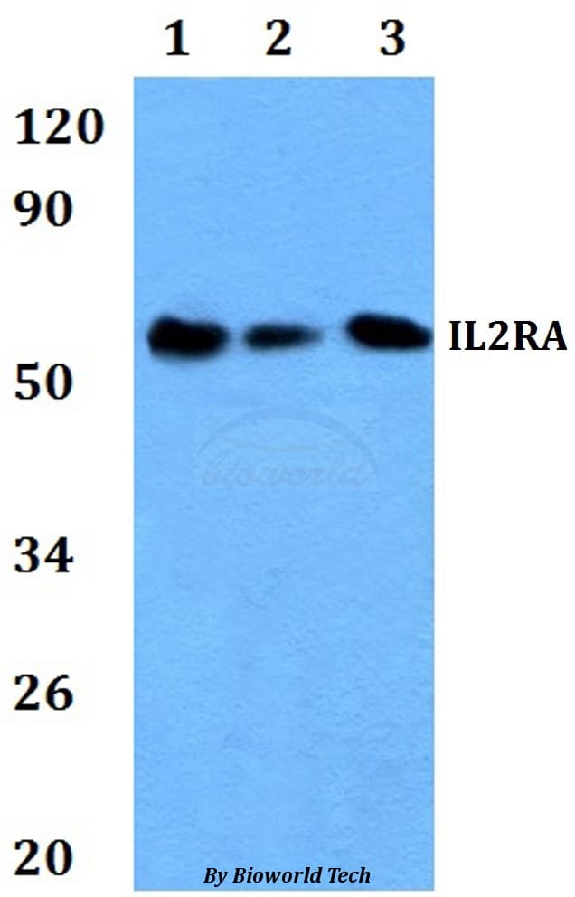 Polyclonal Rabbit anti-Human IL2RA / CD25 Antibody (WB)