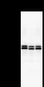 DDX17 Antibody (clone 2248C2a)
