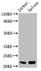 HIST1H1C Antibody