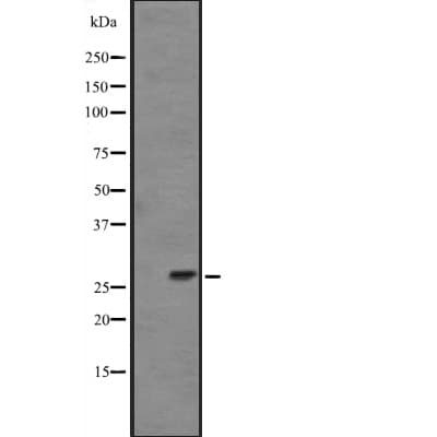 Polyclonal Rabbit anti-Human FGF14 Antibody (WB)