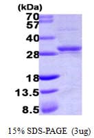Human CMPK / CMPK1 Protein (Recombinant His)