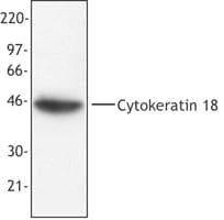 IHC-plus™ Monoclonal Mouse anti-Human KRT18 / CK18 / Cytokeratin 18 Antibody (clone DA-7, IHC, WB)
