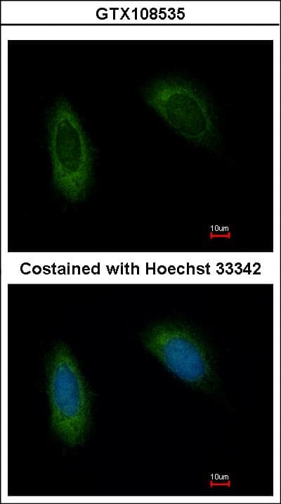 IHC-plus™ TRAM1 Antibody (aa310-374)