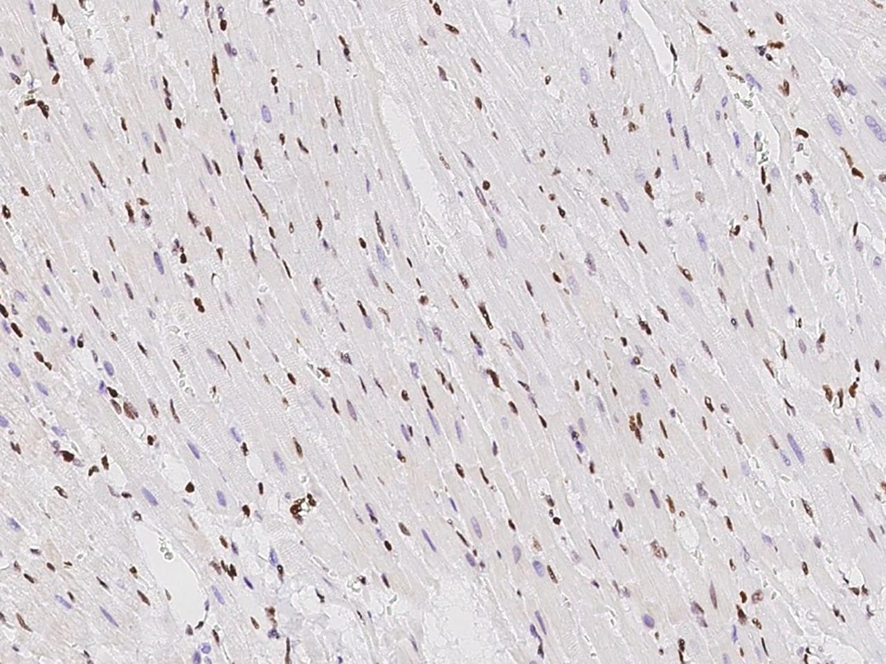 TBX5 Antibody (Preservative Free)
