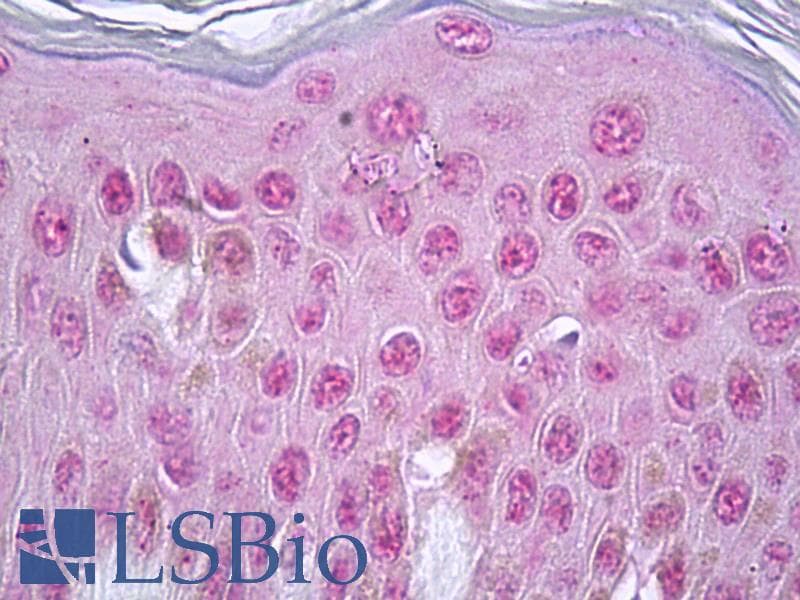 IHC-plus™ Polyclonal Rabbit anti-Human Vitamin D Receptor / VDR Antibody (aa181-230, IHC, IF, WB)