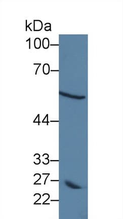 DCT / Dopachrome Tautomerase Antibody (aa28-263)