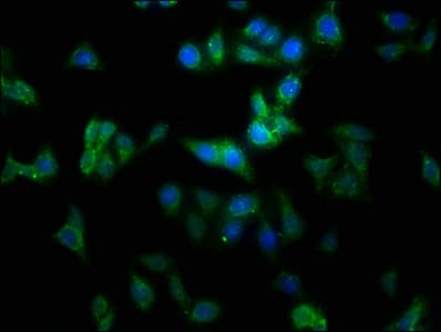 MMGT1 Antibody (aa66-131)