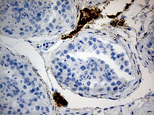 C4orf49 / OSAP Antibody (clone OTI3D9)