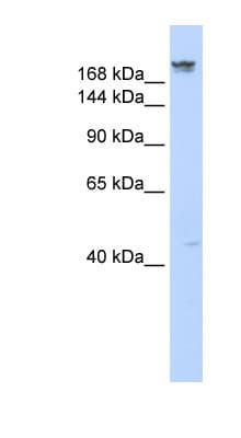 Polyclonal Rabbit anti-Human Dysferlin Antibody (aa1584-1633, WB)