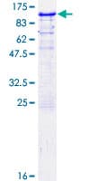 Human RBM5 / G15 Protein (Recombinant GST)