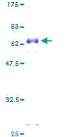 Human DLX5 Protein (Recombinant GST)