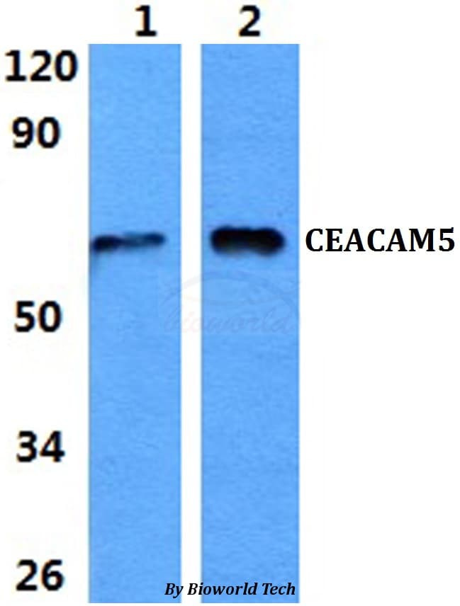 CEACAM5 / CD66e Antibody
