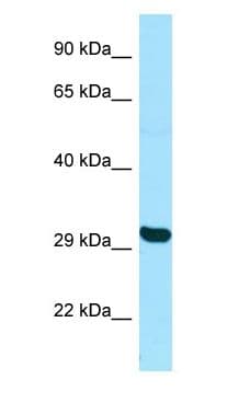 TBPL2 / TRF3 Antibody (aa91-140)