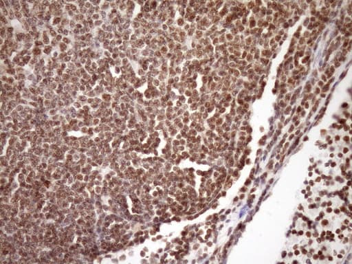 Monoclonal Mouse anti-Human SYF2 / p29 Antibody (clone OTI6A5, aa2-92, IHC, WB)
