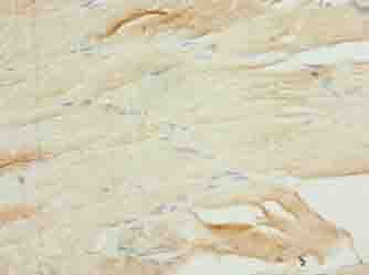 Polyclonal Rabbit anti-Human RASL10B Antibody (IHC)