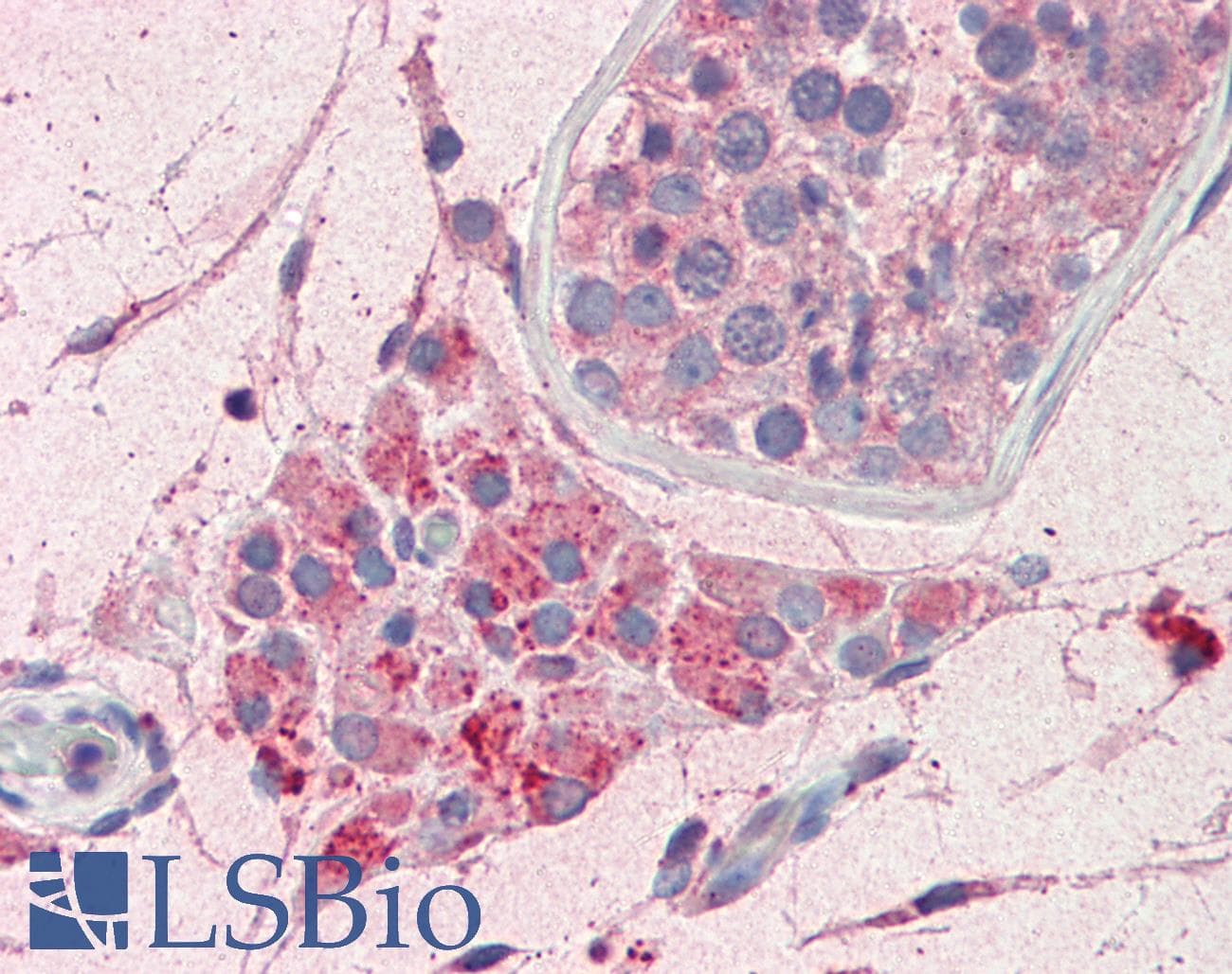 IHC-plus™ PIM2 / Pim-2 Antibody (aa287-299)