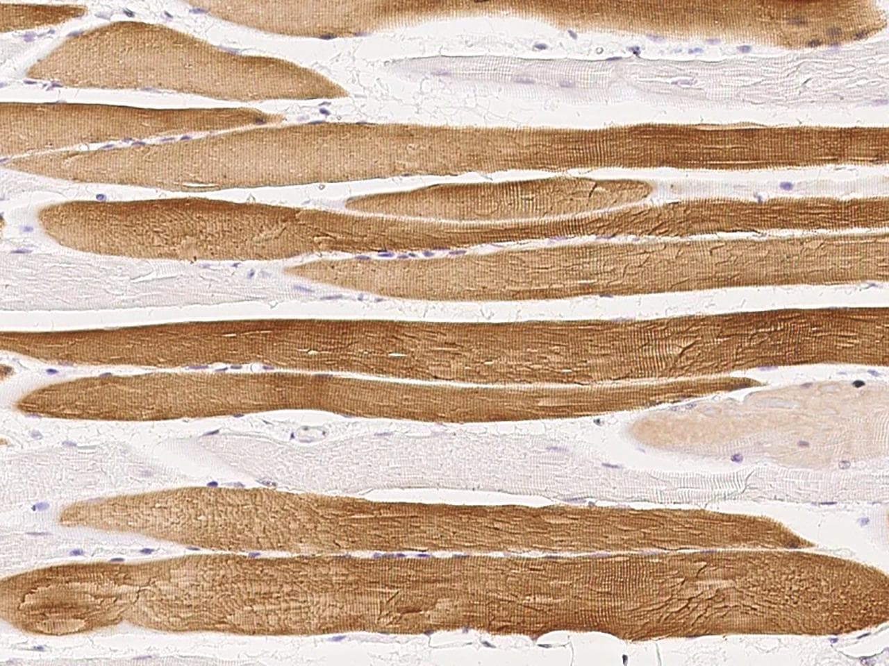 TNNC1 / Cardiac Troponin C Antibody (Preservative Free)
