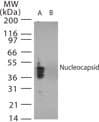 Polyclonal Rabbit anti-Coronavirus SARS-CoV Nucleoprotein Antibody (aa84-99, WB)