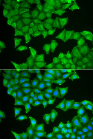 Polyclonal Rabbit anti-Human PTGES3 / p23 Antibody (IHC, IF, WB)