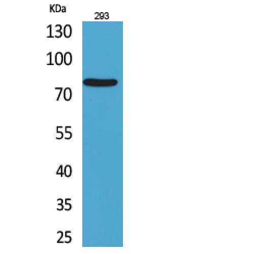 Polyclonal Rabbit anti-Human BCL6 Antibody (271-320 aa, Internal, IHC, WB)