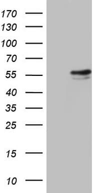 RAD23B / HR23B Antibody (aa1-253, clone OTI7C5)