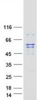 Human GLYCTK / Glycerate Kinase Protein (Recombinant Myc-DDK (Flag))