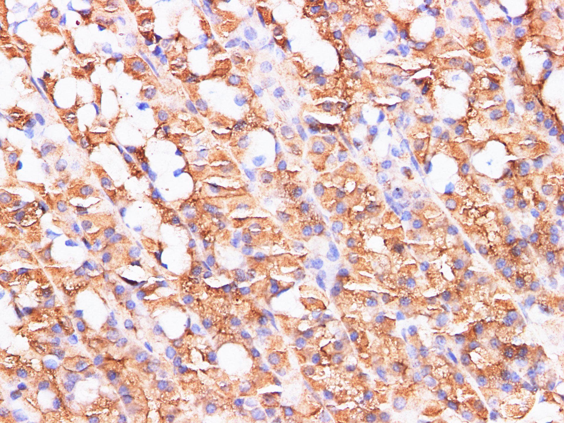Polyclonal Rabbit anti-Rat S100A9 / MRP14 Antibody (IHC, WB)